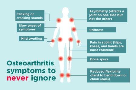 osteoarthritis-image